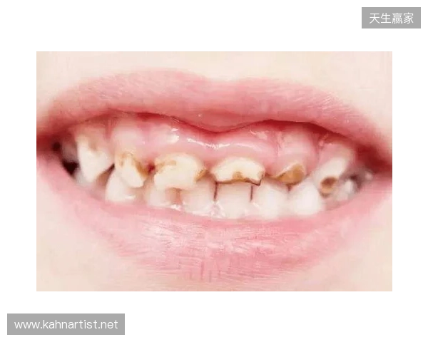 韦林顿确诊上唇部贯通伤;11、21牙半脱位;上颌前牙区牙槽骨骨折